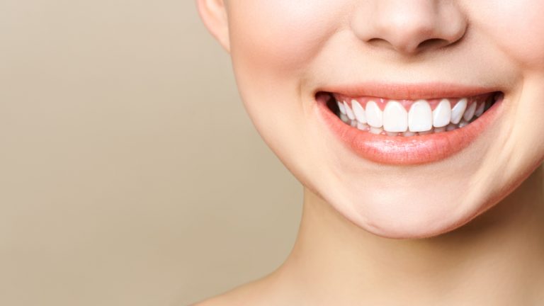 Common Questions: Teeth Whitening Treatment Near Me, Norwalk CA