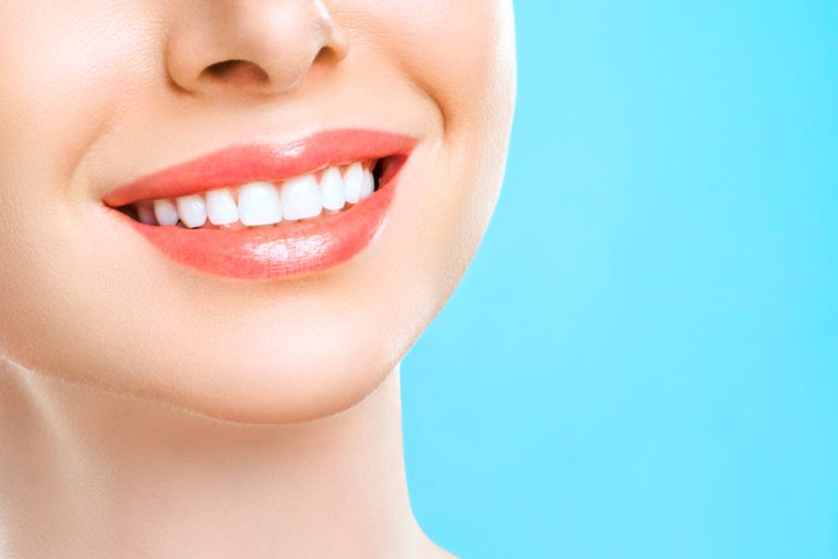 FAQs – In-Office Teeth Whitening in Norwalk