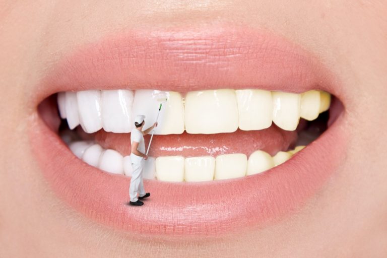 Teeth Whitening Treatment Near Me in Norwalk