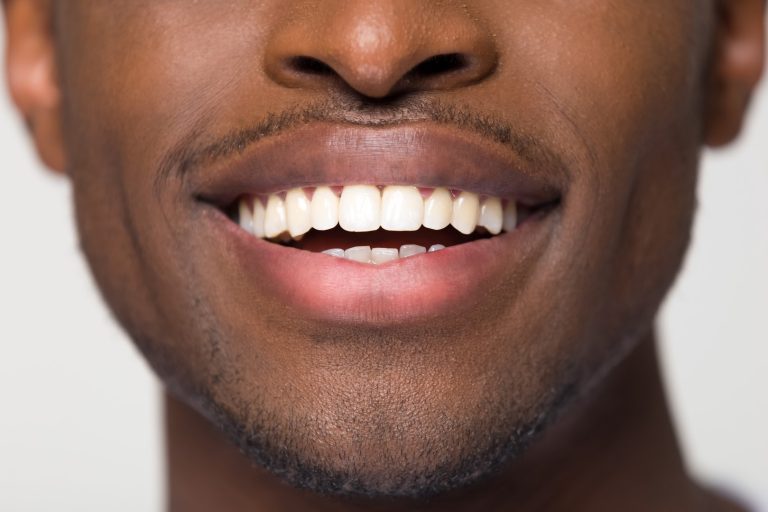 Best Dentist Near Me in Norwalk, CA