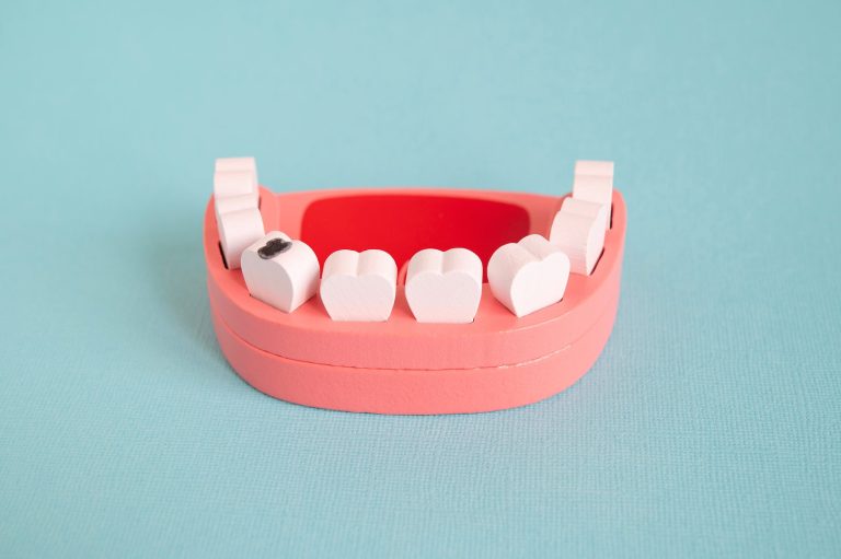 What Are the Signs of Tooth Decay, and Which Dentist Can Help in Norwalk, CA?